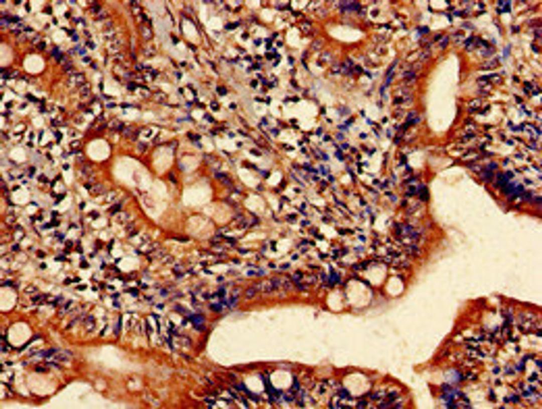 Immunohistochemistry of paraffin-embedded human small intestine tissue using CSB-PA010737LA01HU at dilution of 1:100