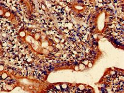 Immunohistochemistry of paraffin-embedded human small intestine tissue using CSB-PA010737LA01HU at dilution of 1:100