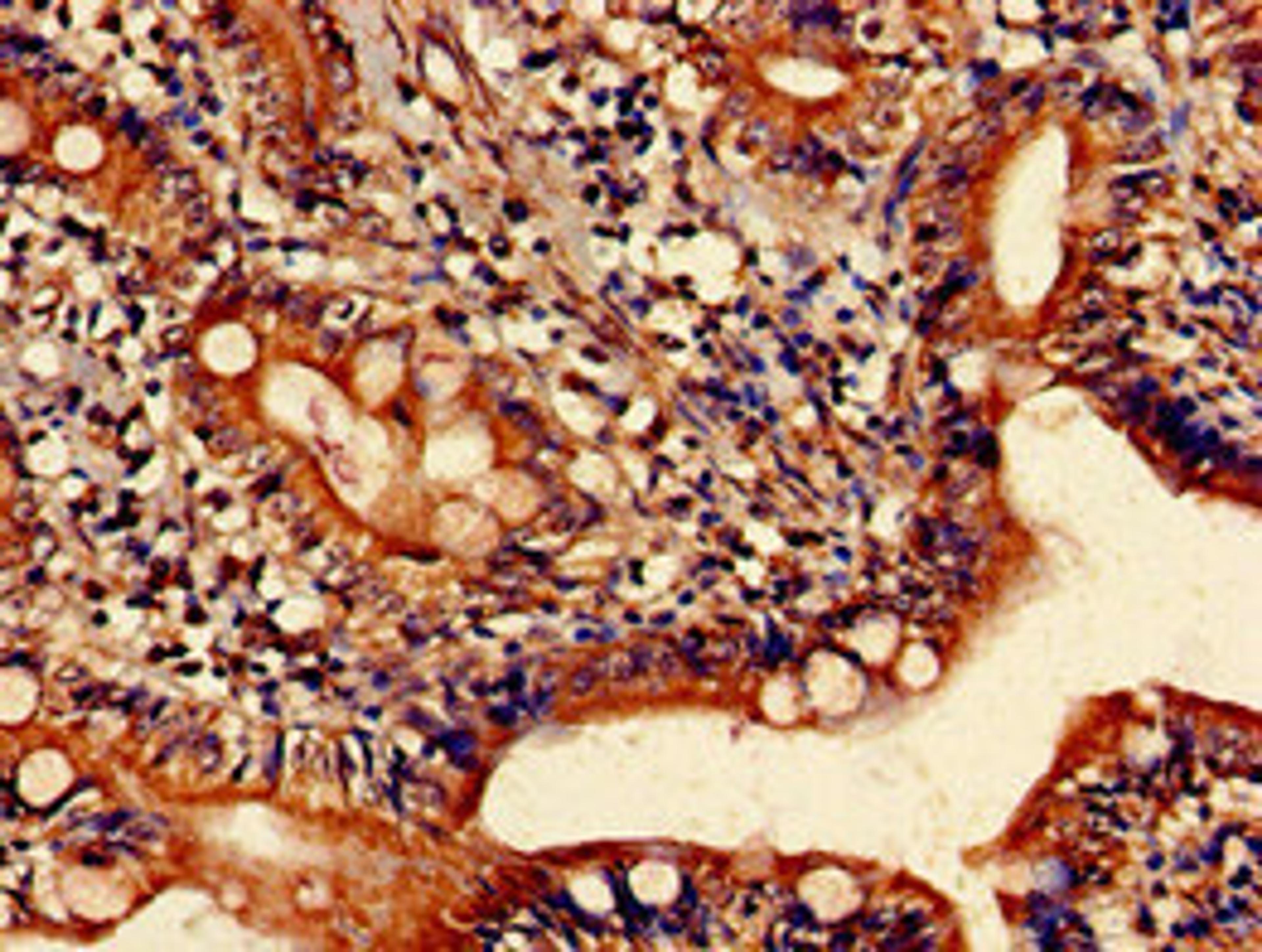 Immunohistochemistry of paraffin-embedded human small intestine tissue using CSB-PA010737LA01HU at dilution of 1:100