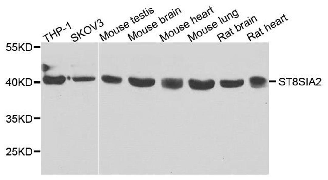 Western blot analysis of extracts of various cells using ST8SIA2 antibody