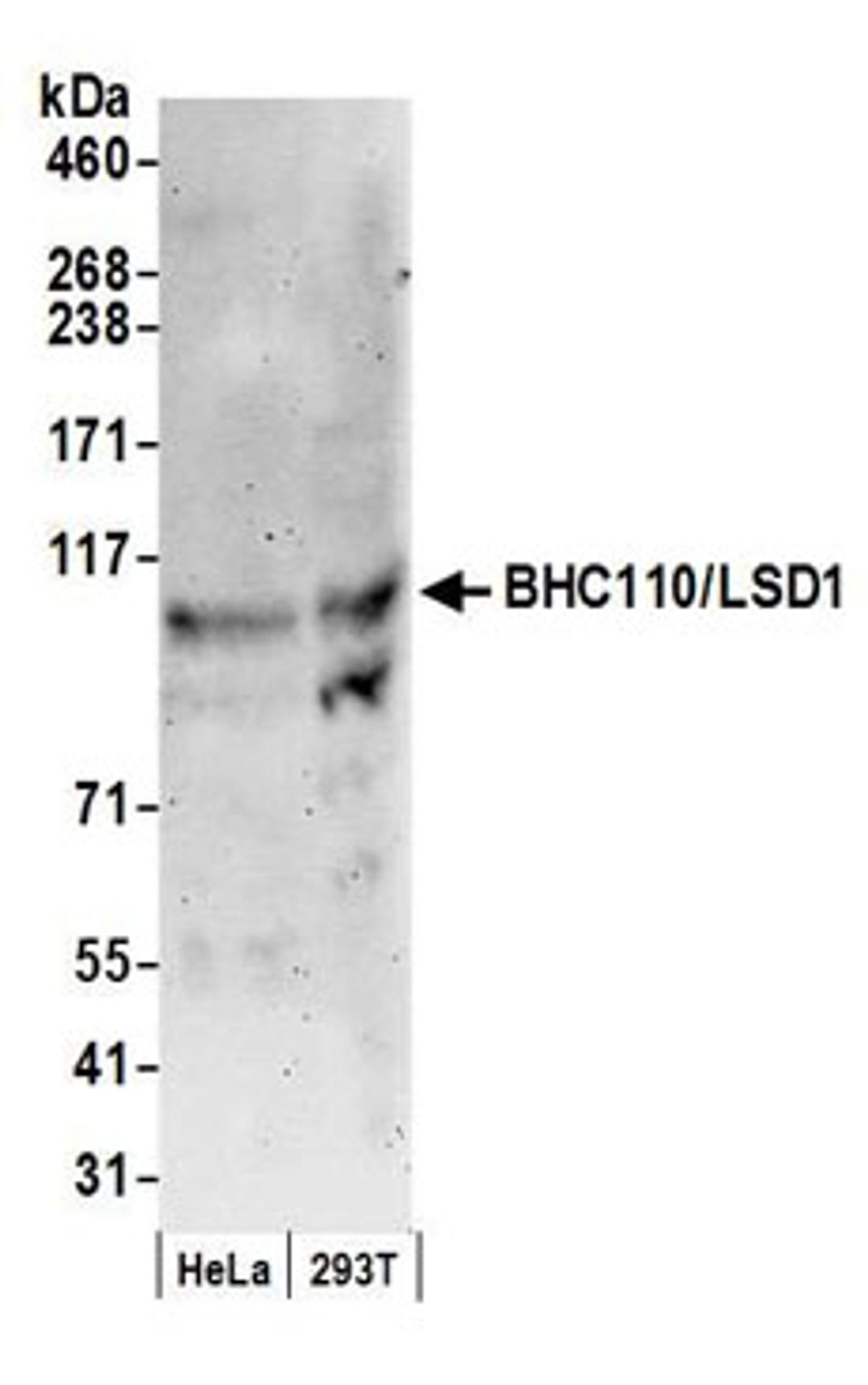 Detection of human BHC110/LSD1 by western blot.