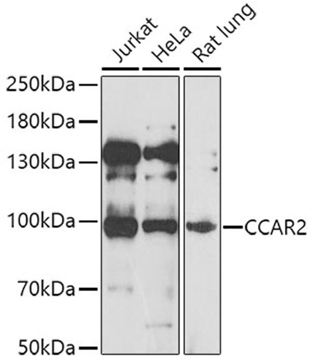 Western blot - CCAR2 antibody (A7126)