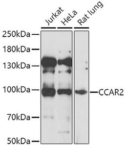 Western blot - CCAR2 antibody (A7126)