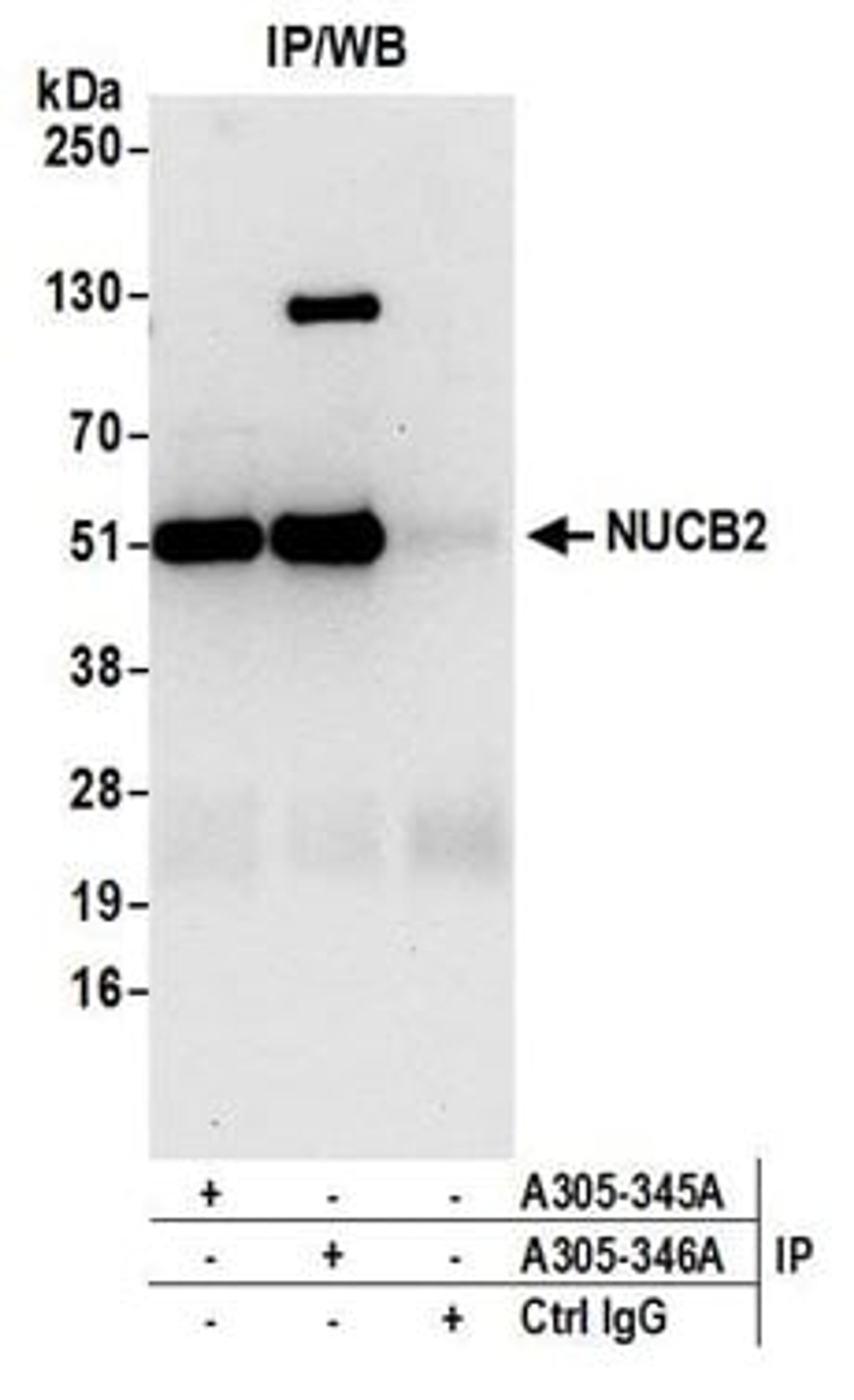 Detection of human NUCB2 by western blot of immunoprecipitates.