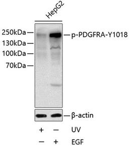 Western blot - Phospho-PDGFRA-Y1018 antibody (AP0615)