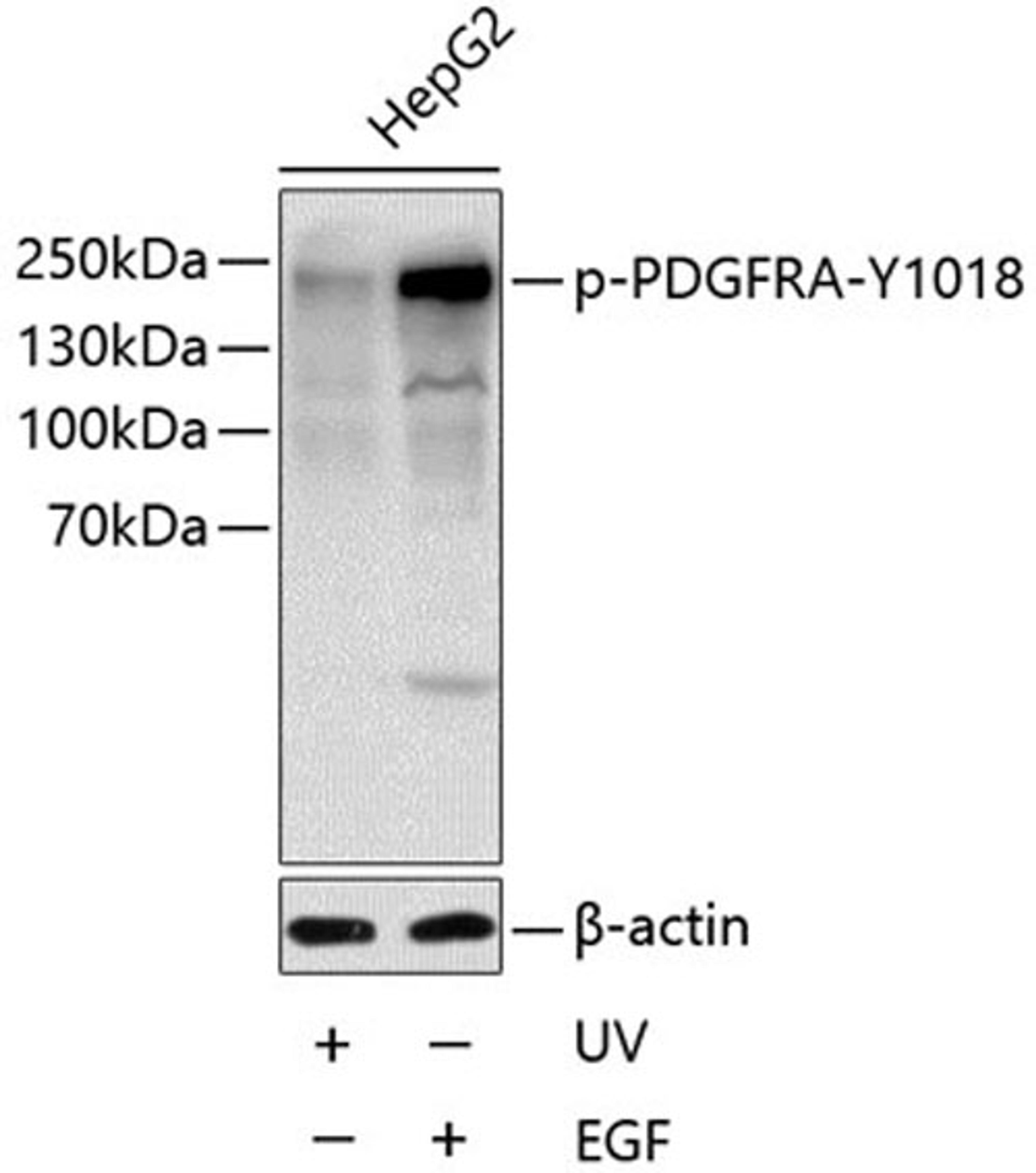 Western blot - Phospho-PDGFRA-Y1018 antibody (AP0615)