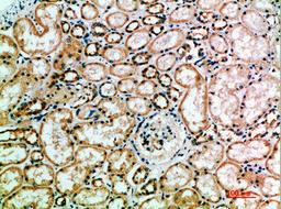 Immunohistochemical analysis of paraffin-embedded human-kidney, antibody was diluted at 1:200