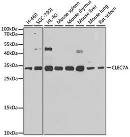 Western blot - CLEC7A antibody (A9883)