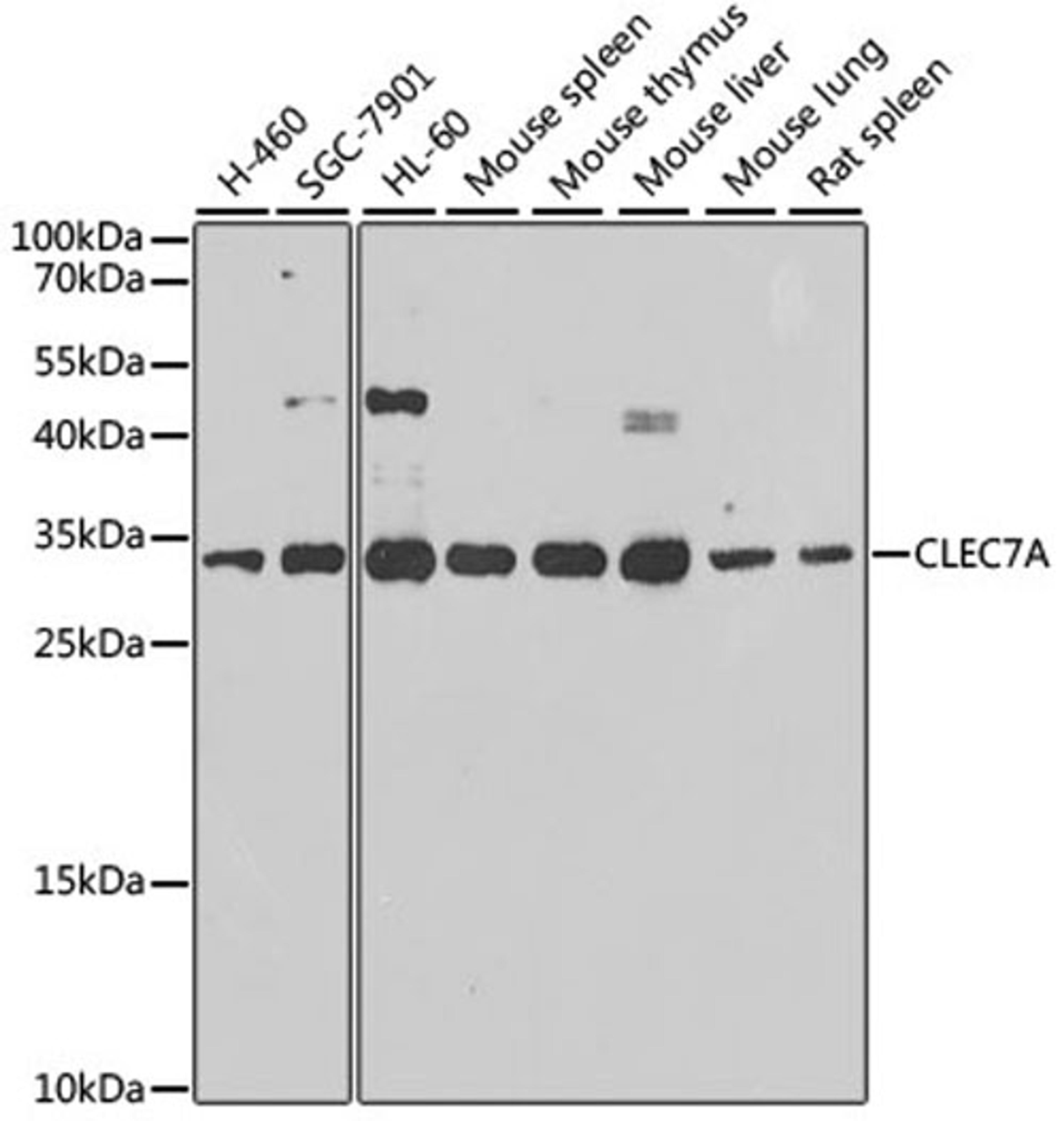 Western blot - CLEC7A antibody (A9883)