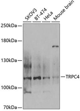 Western blot - TRPC4 antibody (A6996)