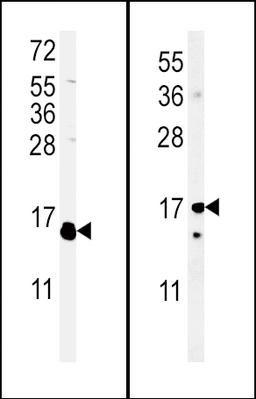 (LEFT)Western blot analysis of IL4 Antibody in WiDr cell line lysates (35ug/lane).IL4 (arrow) was detected using the purified Pab.(RIGHT)Western blot analysis of IL4 Antibody in mouse cerebellum cell line lysates (35ug/lane).IL4(arrow) was detected using 