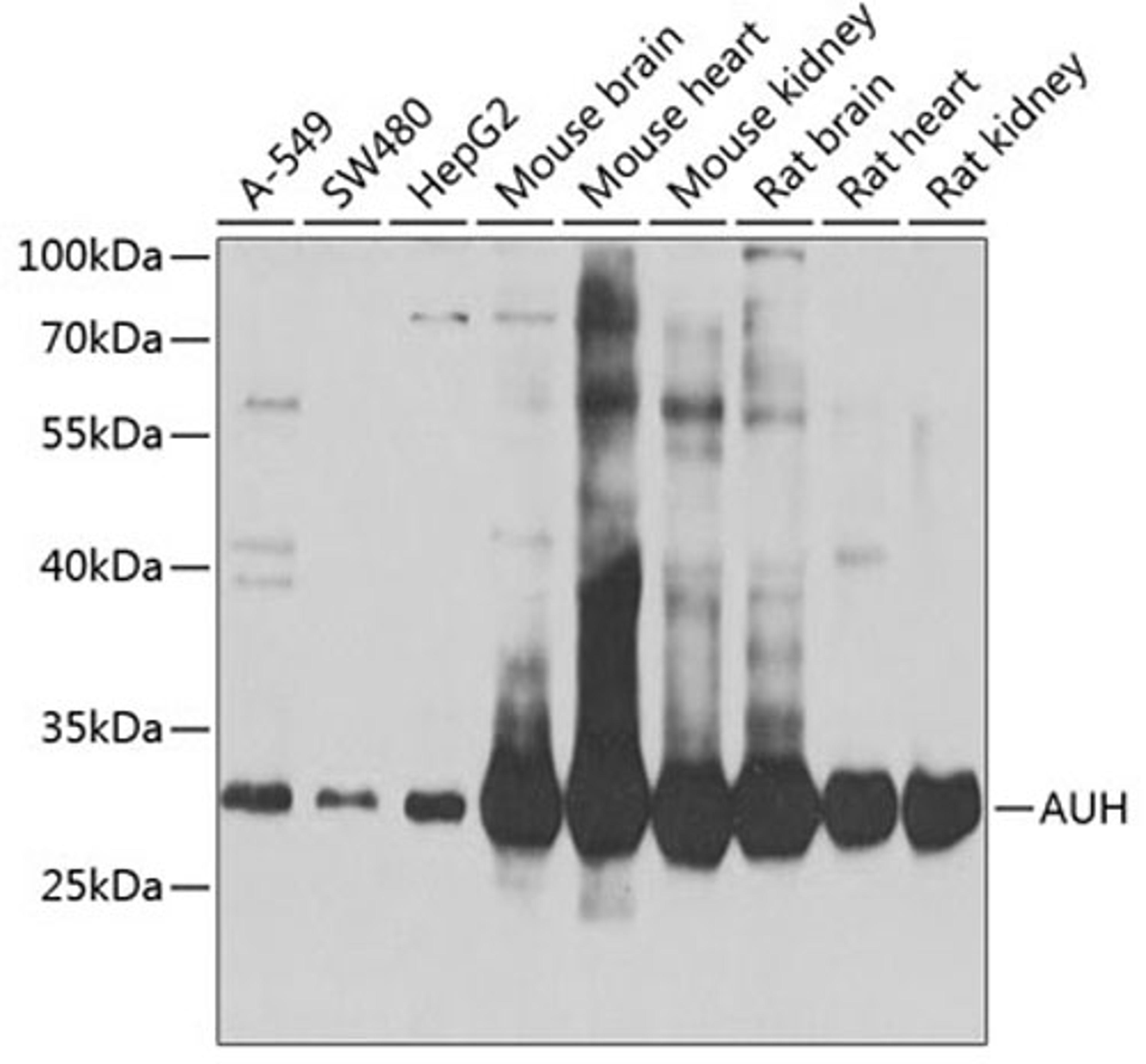 Western blot - AUH antibody (A7424)