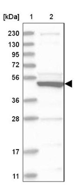 Western Blot: SLC10A3 Antibody [NBP1-84957] - Lane 1: Marker [kDa] 230, 130, 95, 72, 56, 36, 28, 17, 11<br/>Lane 2: Human cell line RT-4