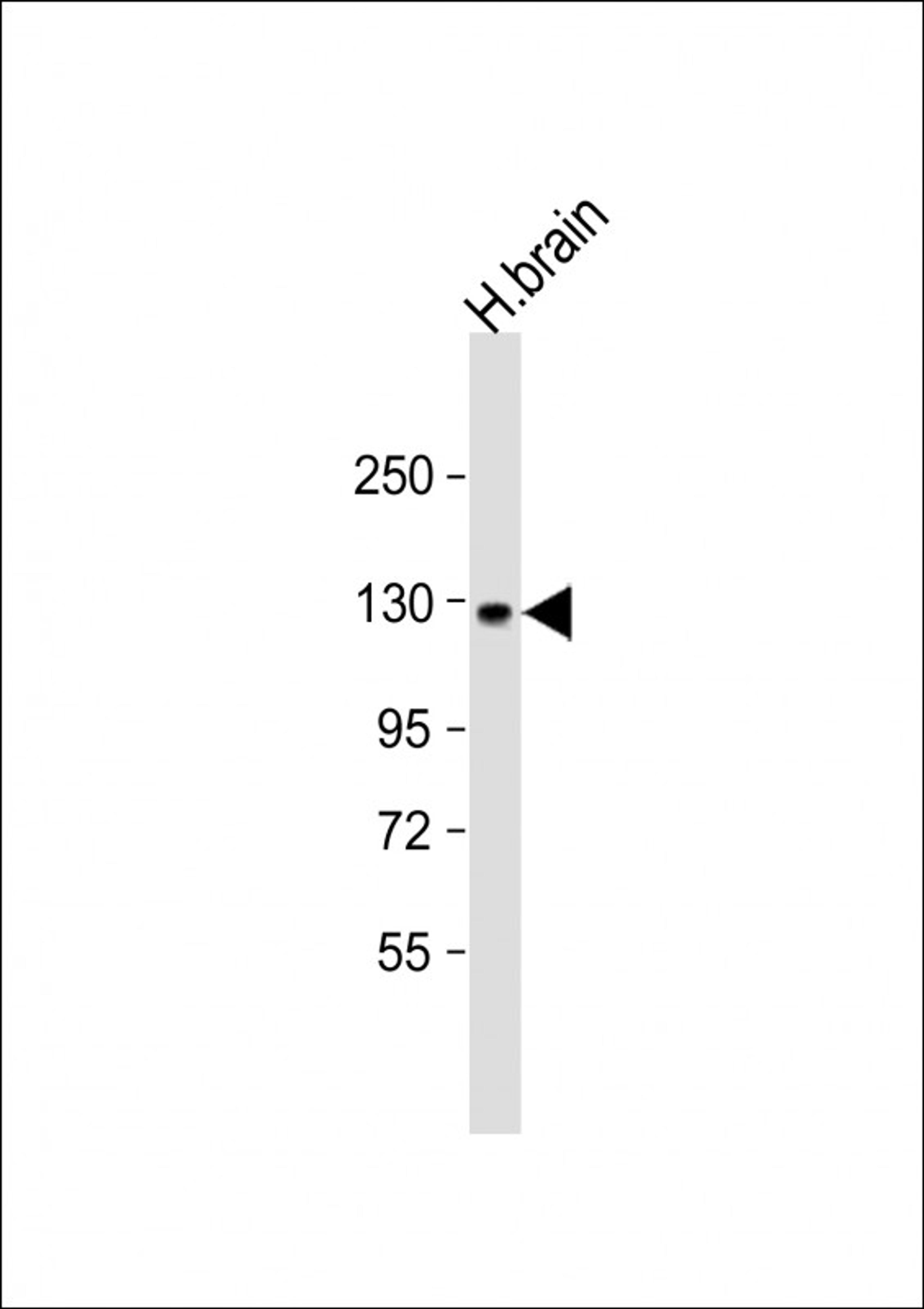 Western Blot at 1:1000 dilution + human brain lysate Lysates/proteins at 20 ug per lane.