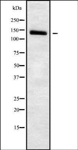 Western blot analysis of HuvEc whole cell lysates using SLC4A7 antibody