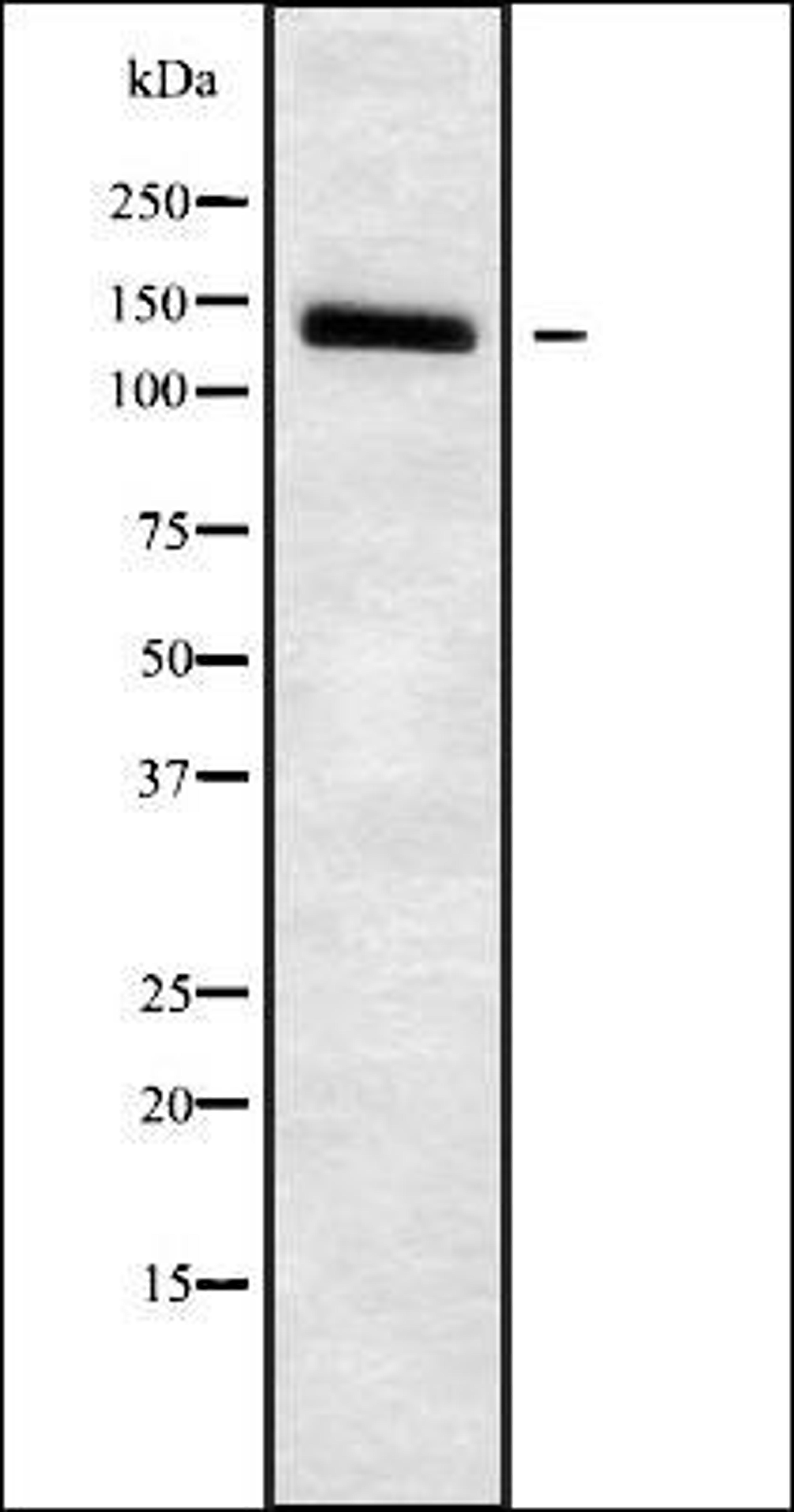 Western blot analysis of HuvEc whole cell lysates using SLC4A7 antibody