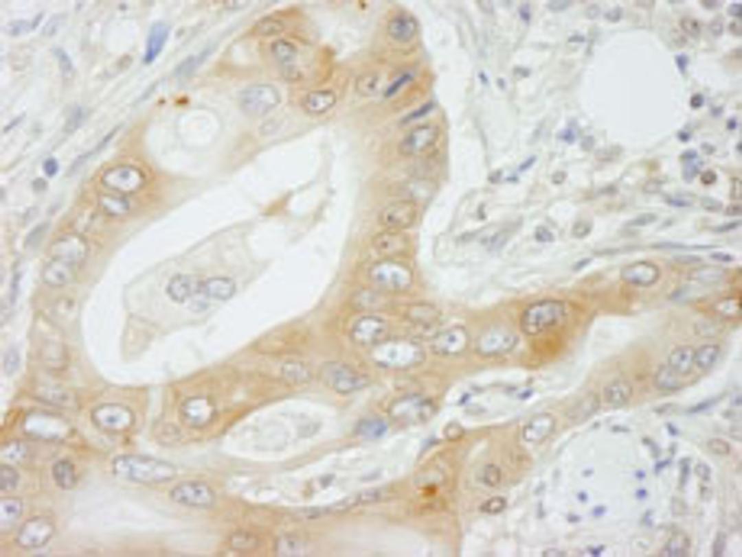 Detection of human NMI by immunohistochemistry.