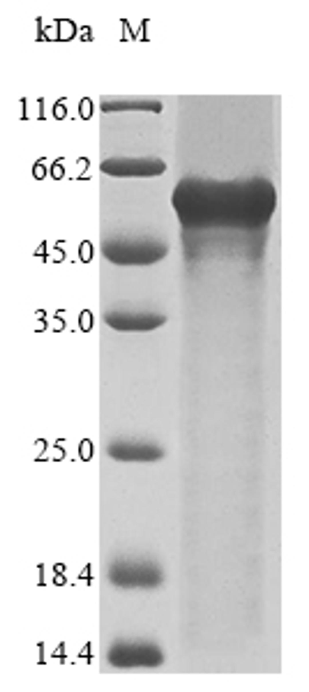 (Tris-Glycine gel) Discontinuous SDS-PAGE (reduced) with 5% enrichment gel and 15% separation gel.