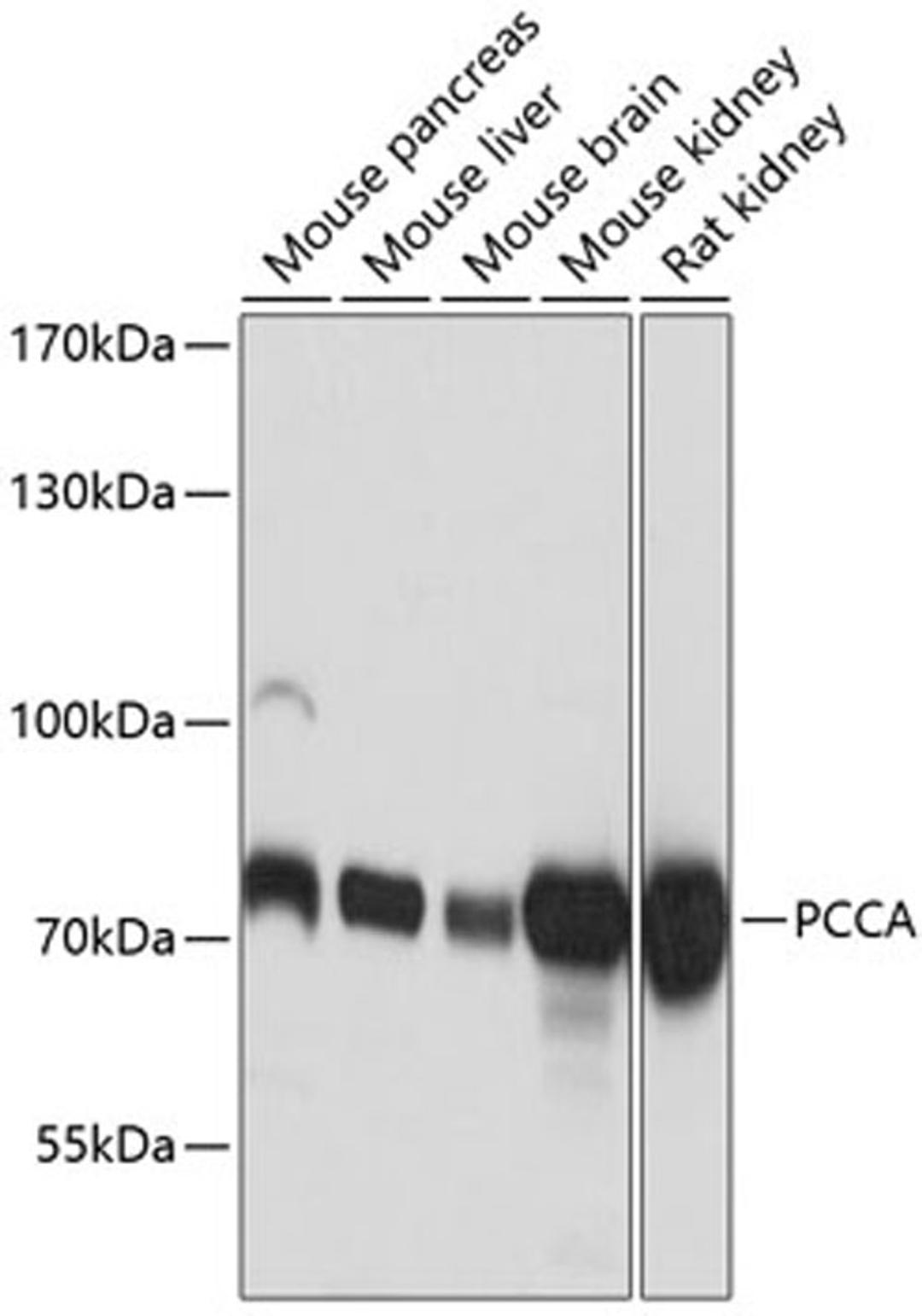 Western blot - PCCA antibody (A9486)