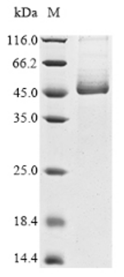 (Tris-Glycine gel) Discontinuous SDS-PAGE (reduced) with 5% enrichment gel and 15% separation gel.