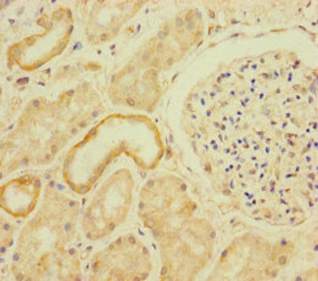 Immunohistochemistry of paraffin-embedded human kidney tissue using CSB-PA687456LA01HU at dilution of 1:100