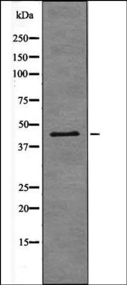 Western blot analysis of PMA treated 293 whole cell lysates using Connexin 43 -Phospho-Ser282- antibody