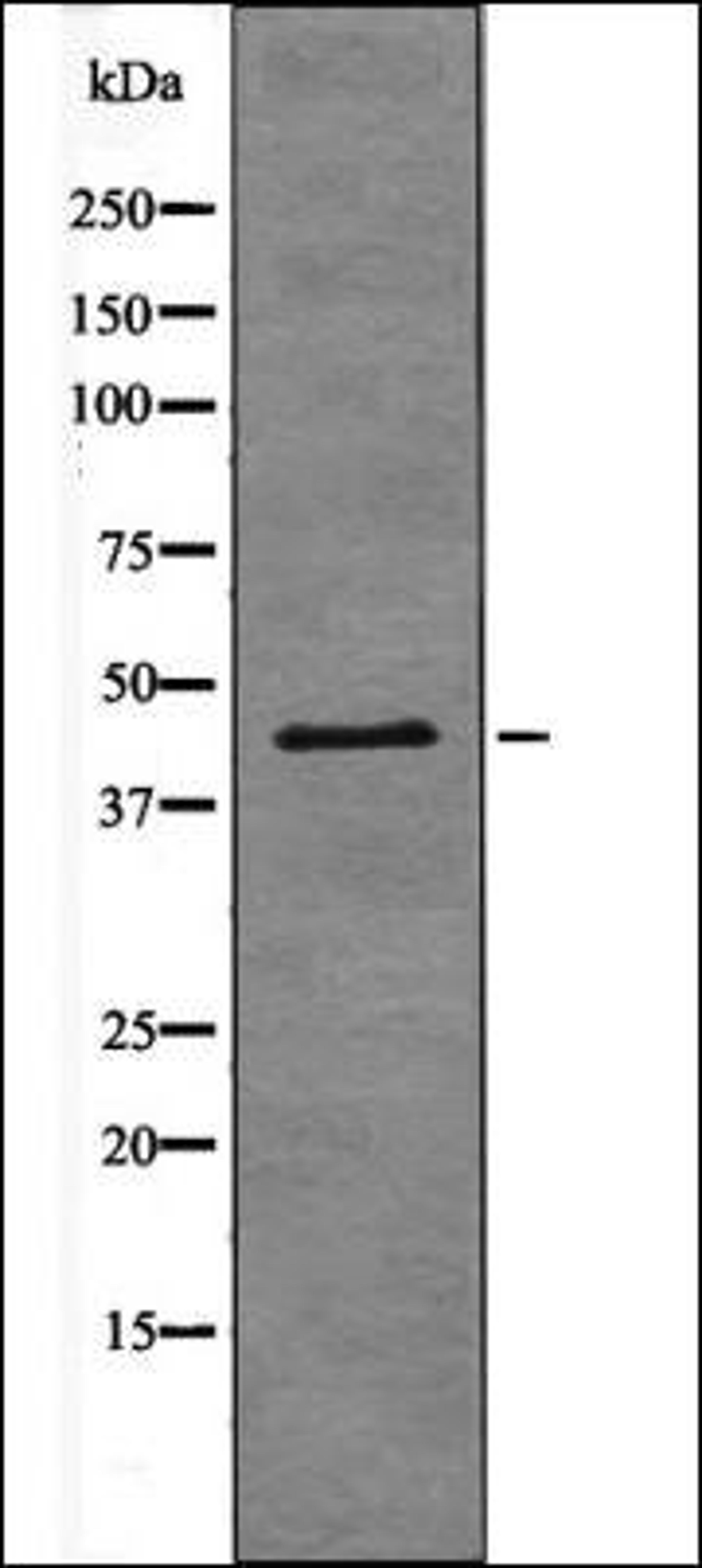 Western blot analysis of PMA treated 293 whole cell lysates using Connexin 43 -Phospho-Ser282- antibody