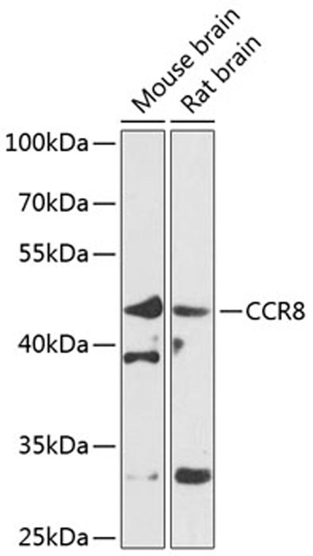 Western blot - CCR8 antibody (A8048)