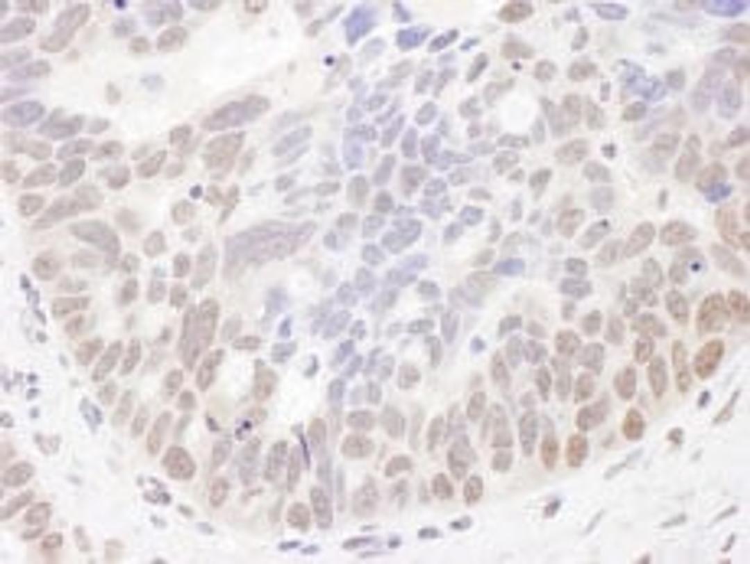 Detection of human NIR by immunohistochemistry.