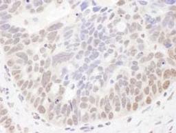 Detection of human NIR by immunohistochemistry.