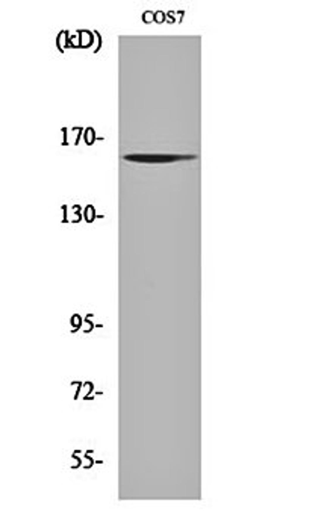 Western blot analysis of COS7 cell lysates using GTBP antibody