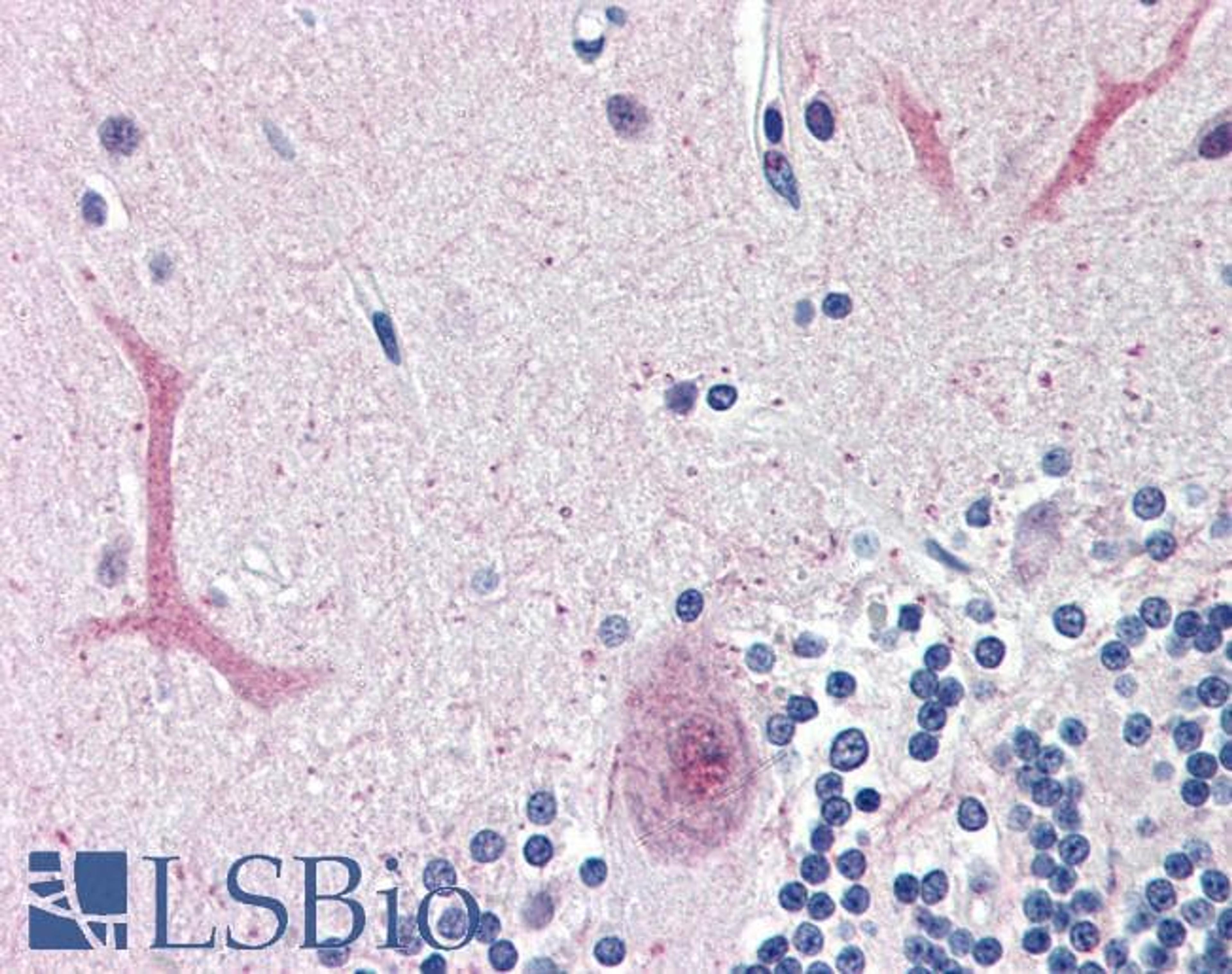 45-603 (3.75ug/ml) staining of paraffin embedded Human Cerebellum. Steamed antigen retrieval with citrate buffer pH 6, AP-staining. 