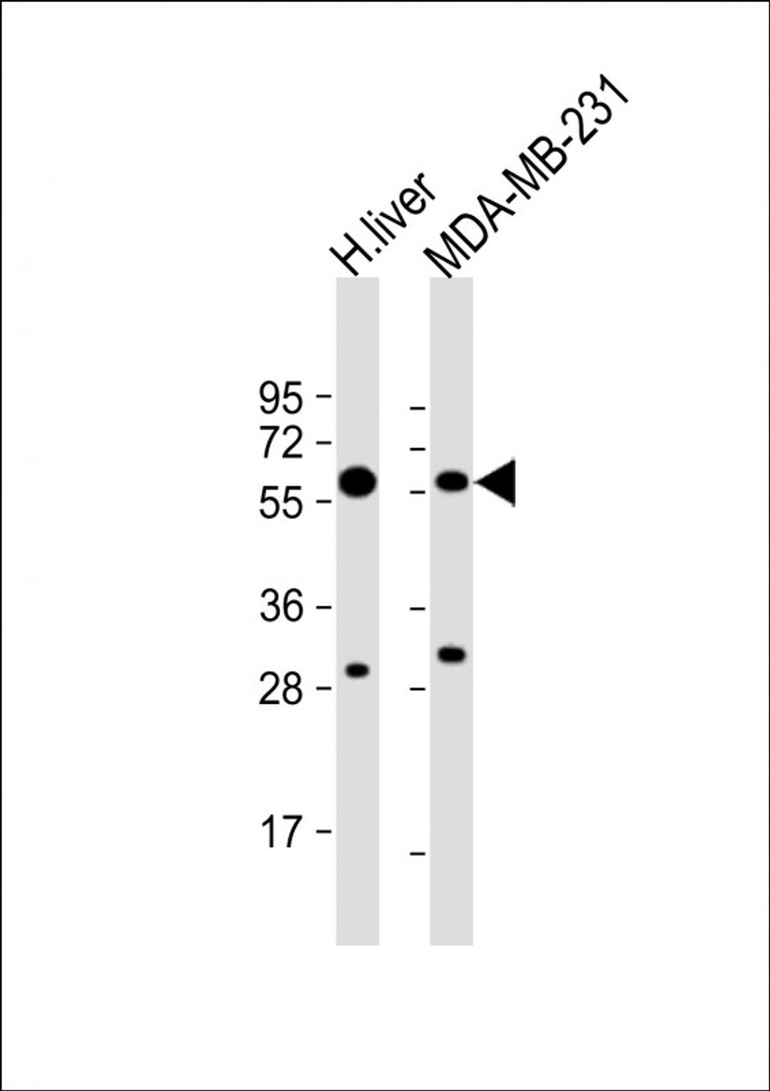 Western Blot at 1:8000 dilution Lane 1: human liver lysate Lane 2: MDA-MB-231 whole cell lysate Lysates/proteins at 20 ug per lane.