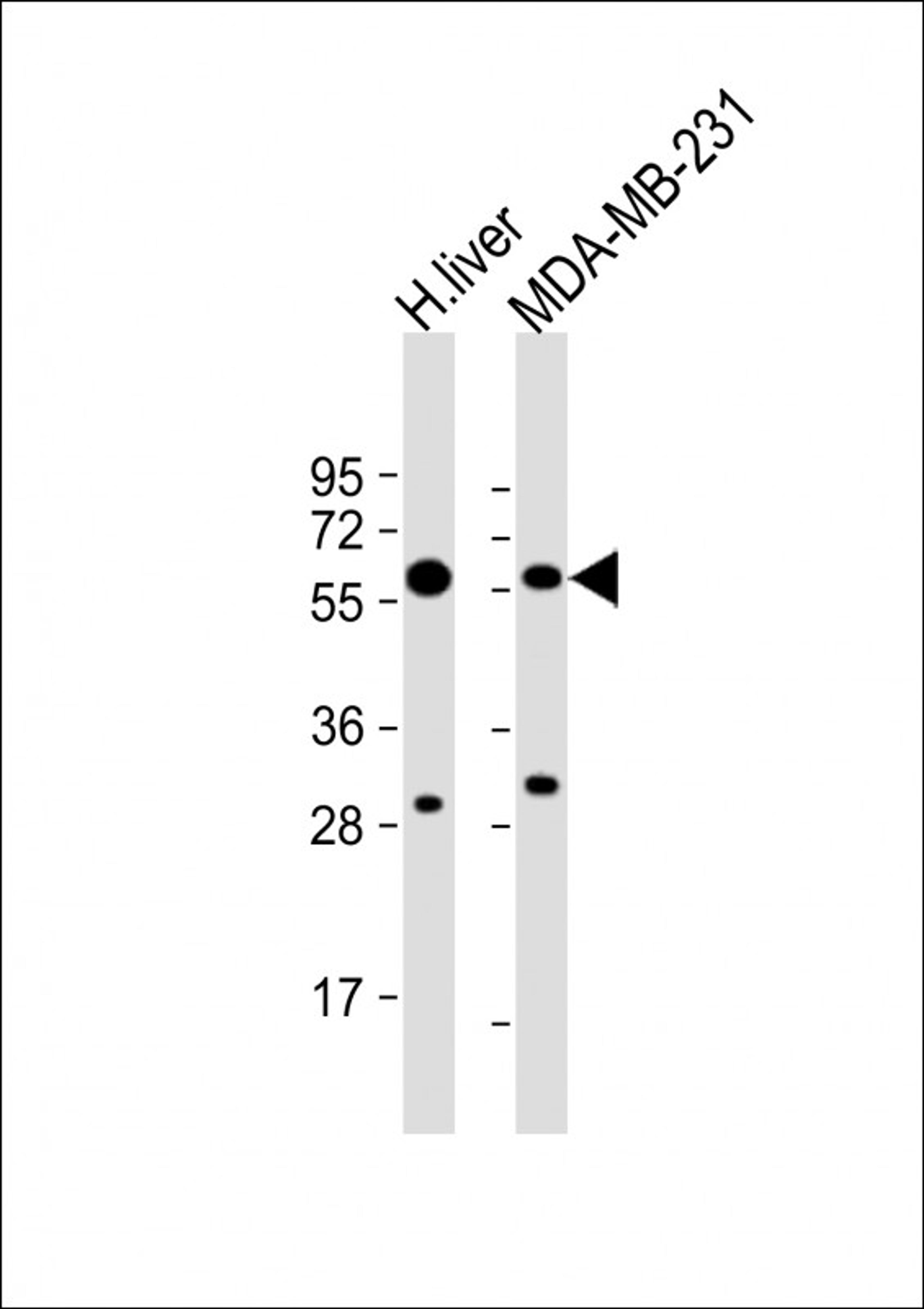 Western Blot at 1:8000 dilution Lane 1: human liver lysate Lane 2: MDA-MB-231 whole cell lysate Lysates/proteins at 20 ug per lane.