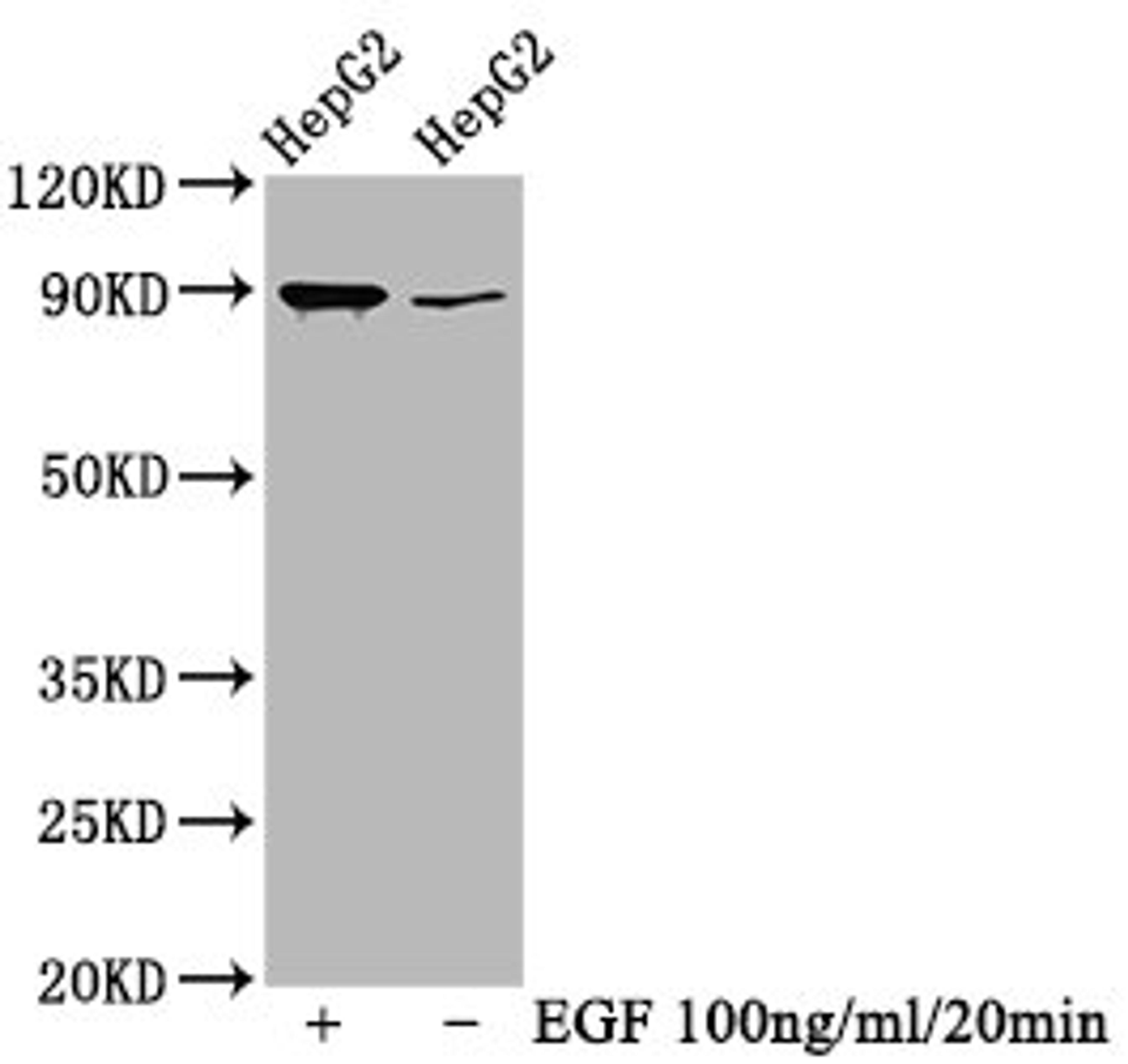 Western Blot. Positive WB detected in HepG2 whole cell lysate(treated with EGF or not). All lanes Phospho-RPS6KA1 antibody at 0.69μg/ml. Secondary. Goat polyclonal to rabbit IgG at 1/50000 dilution. Predicted band size: 90 KDa. Observed band size: 90 KDa. 