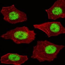 Confocal immunofluoroscence analysis of A549 cell using LMO4 antibody (Center)