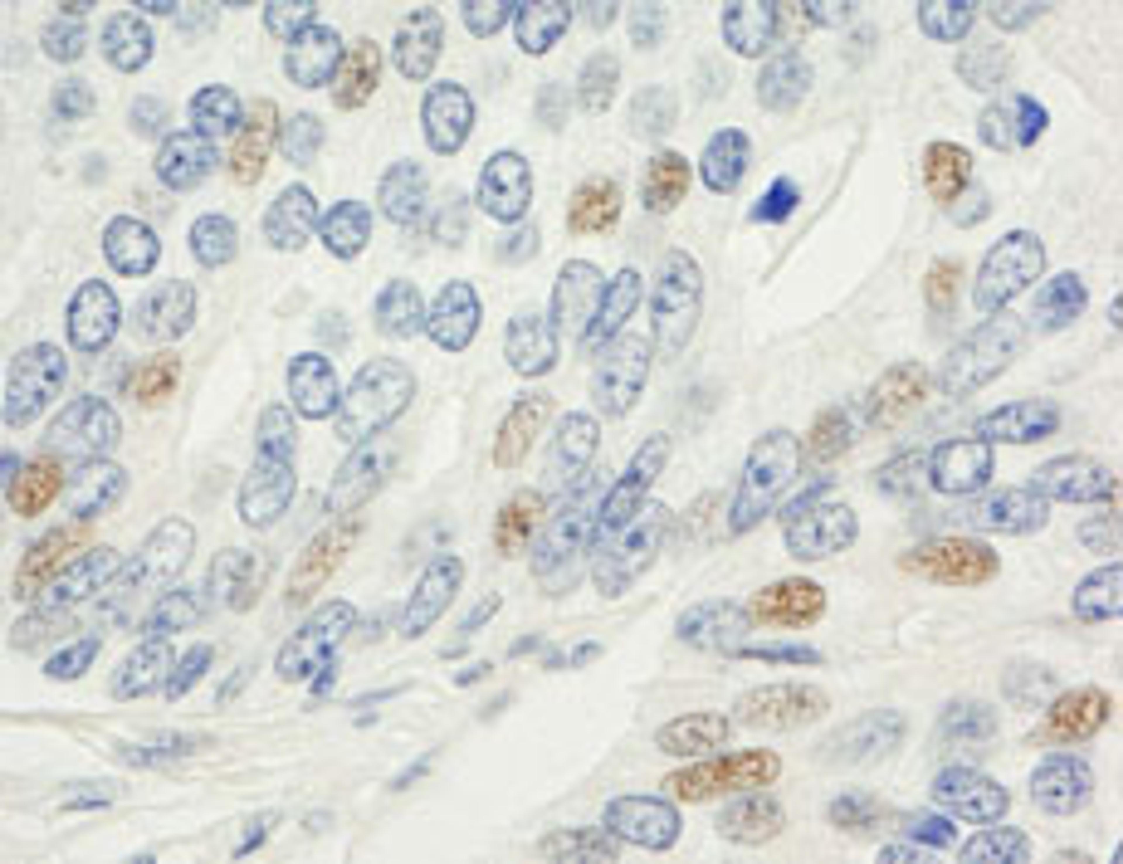 Detection of human MAD1 by immunohistochemistry.