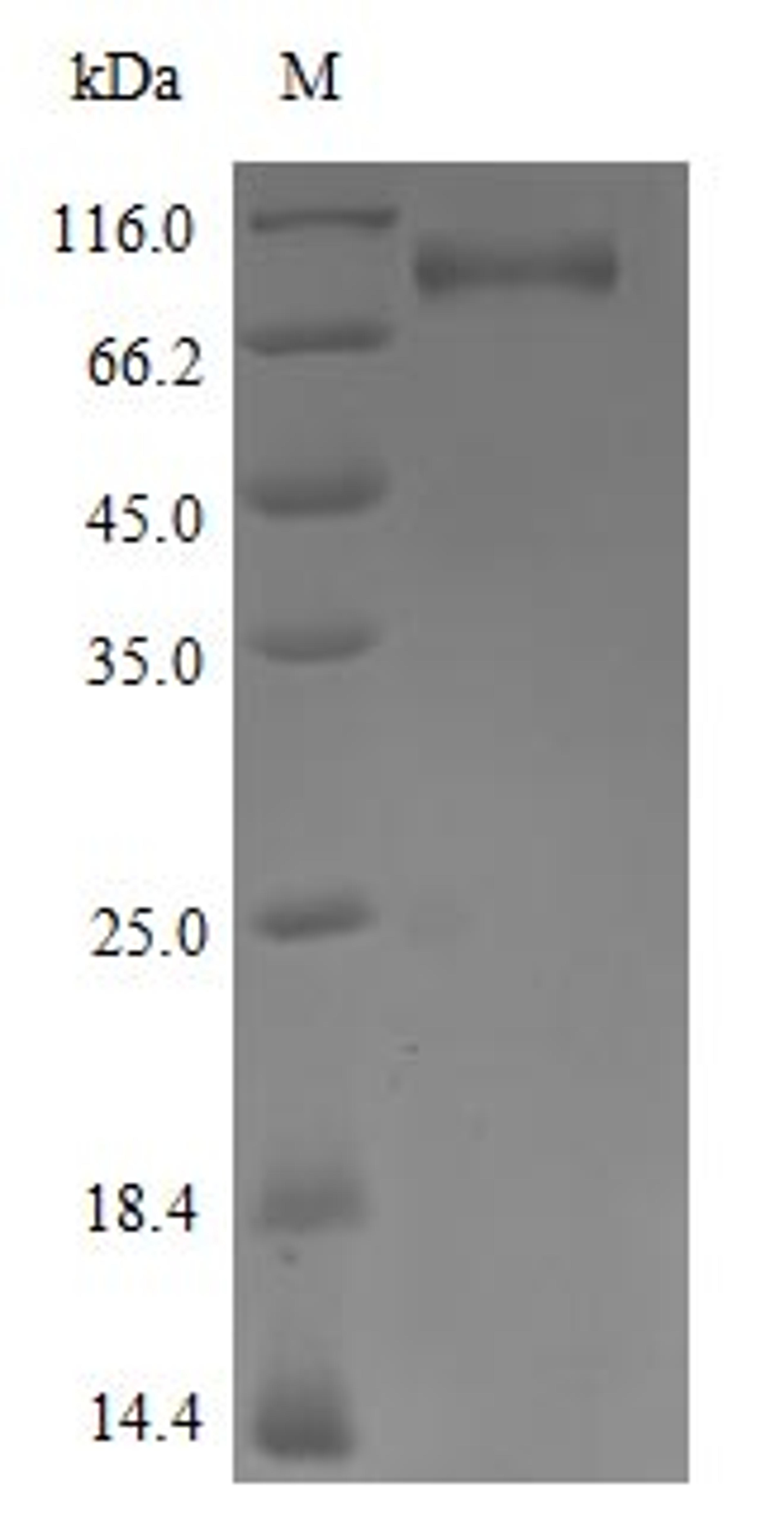 (Tris-Glycine gel) Discontinuous SDS-PAGE (reduced) with 5% enrichment gel and 15% separation gel.