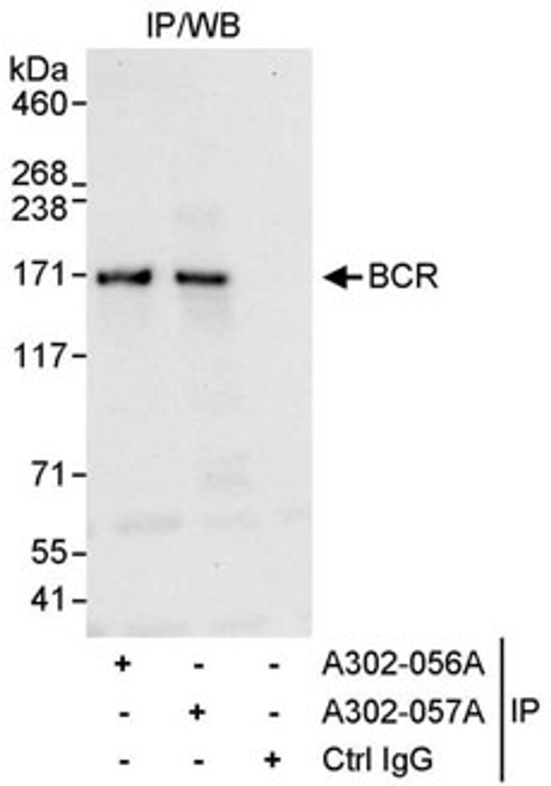 Detection of human BCR by western blot of immunoprecipitates.