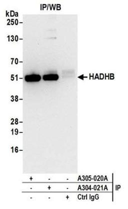 Detection of human HADHB by western blot of immunoprecipitates.