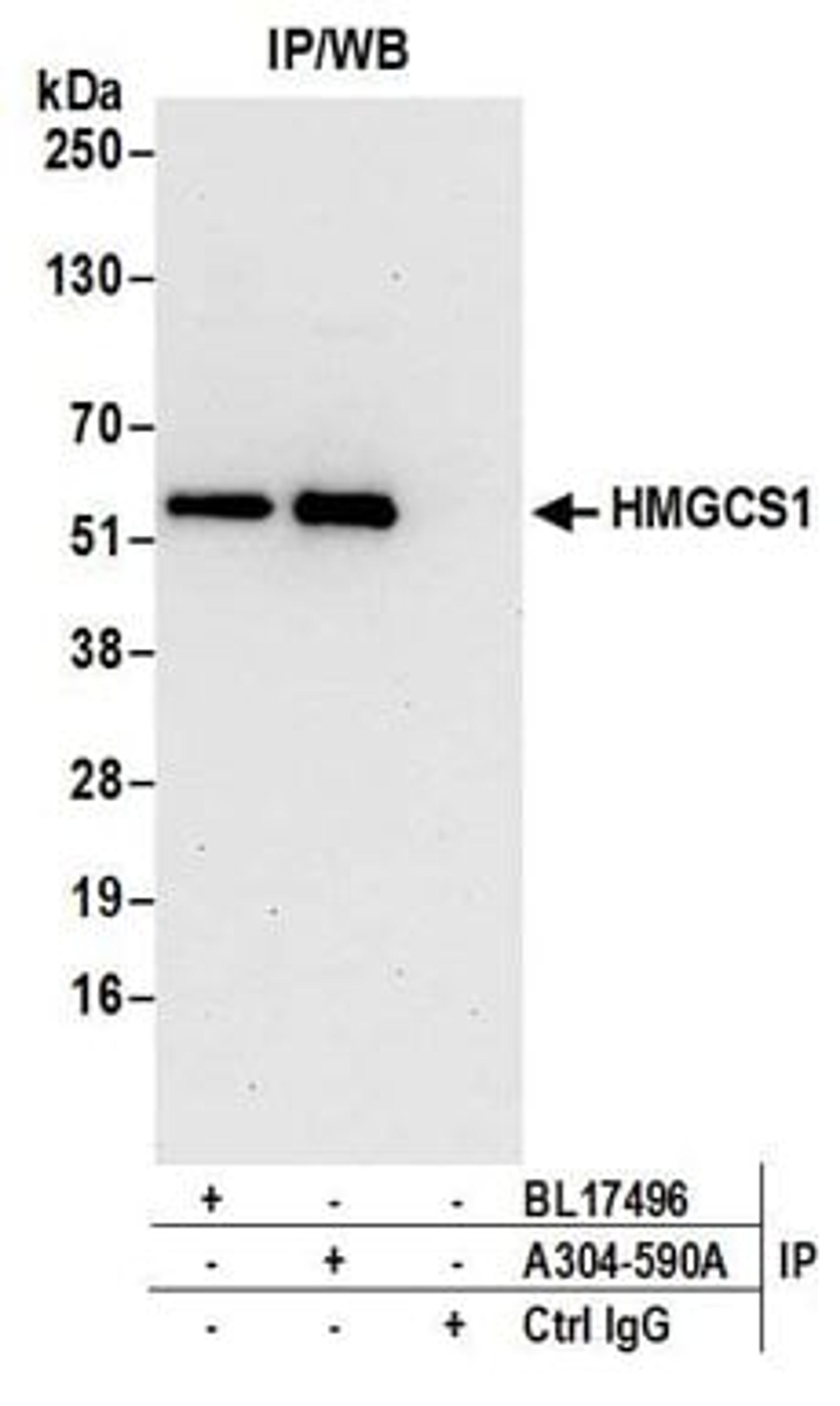 Detection of human HMGCS1 by western blot of immunoprecipitates.