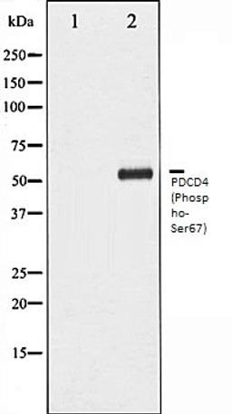 Western blot analysis of HepG2 whole cell lysates using PDCD4 (Phospho-Ser67) antibody, The lane on the left is treated with the antigen-specific peptide.