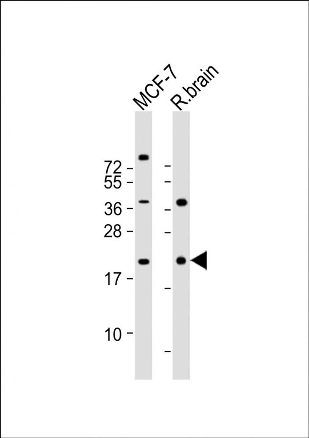 Western Blot at 1:2000 dilution Lane 1: MCF-7 whole cell lysate Lane 2: rat brain lysate Lysates/proteins at 20 ug per lane.