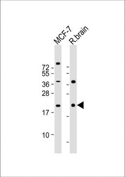 Western Blot at 1:2000 dilution Lane 1: MCF-7 whole cell lysate Lane 2: rat brain lysate Lysates/proteins at 20 ug per lane.