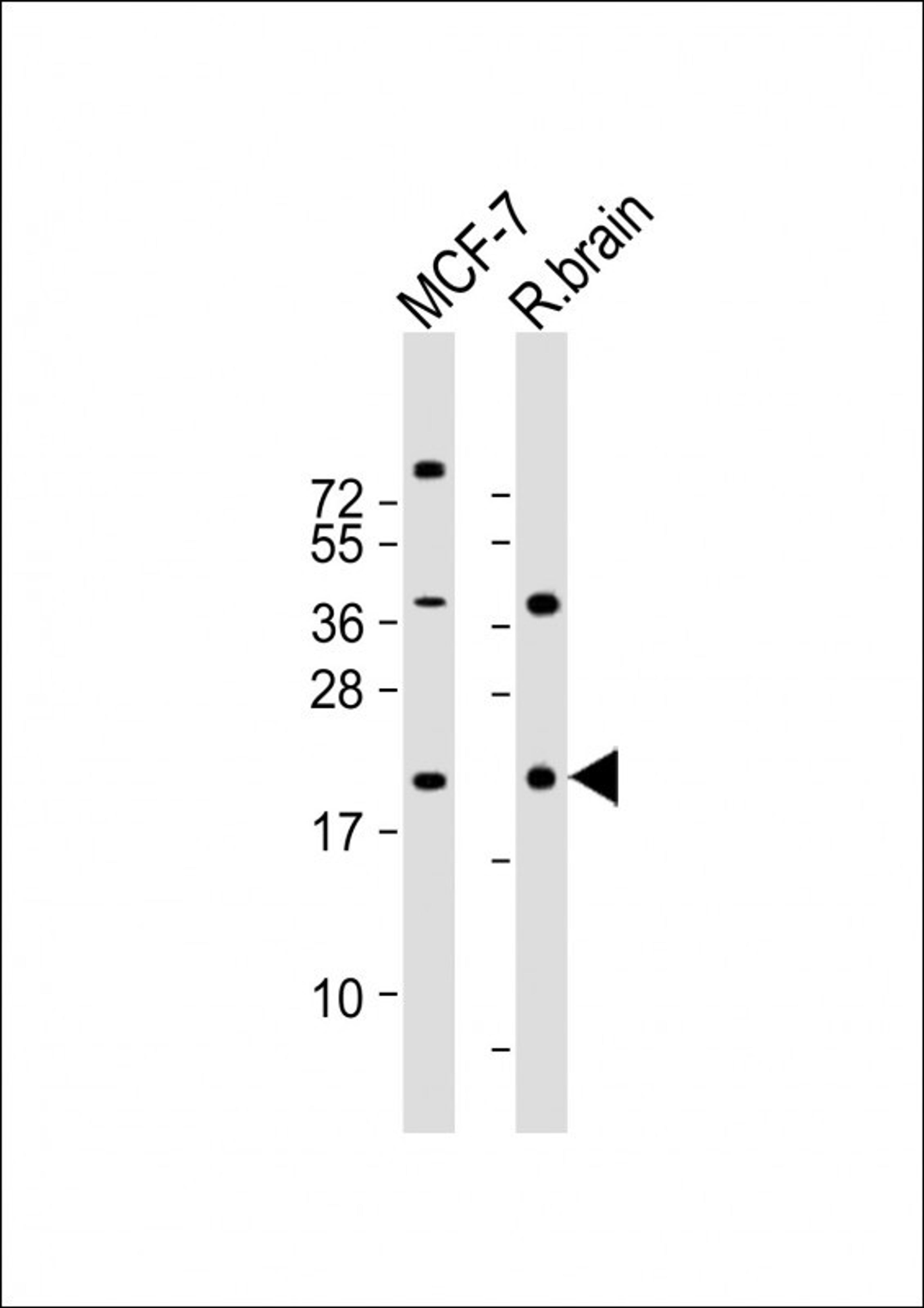 Western Blot at 1:2000 dilution Lane 1: MCF-7 whole cell lysate Lane 2: rat brain lysate Lysates/proteins at 20 ug per lane.