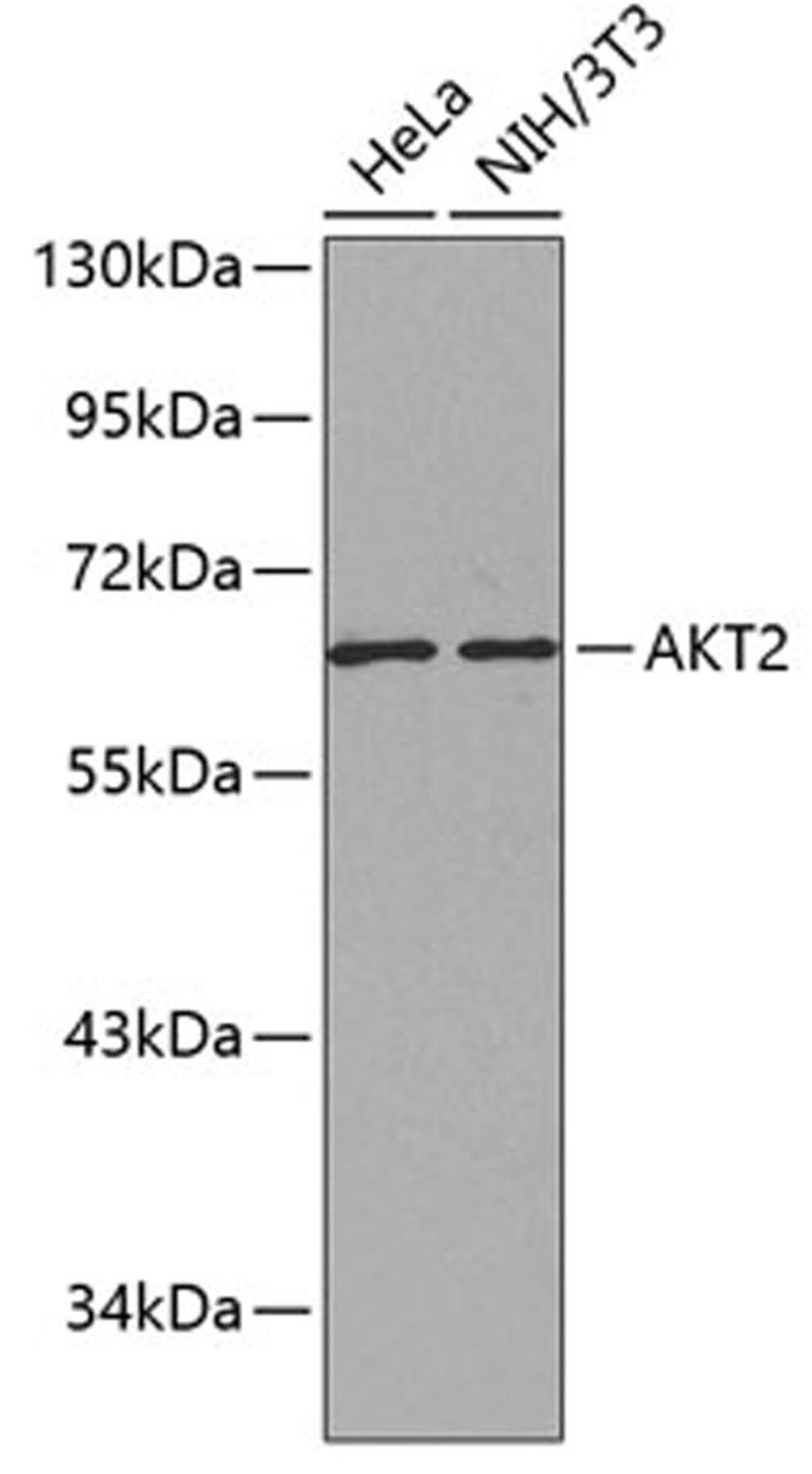 Western blot - AKT2 antibody (A0336)