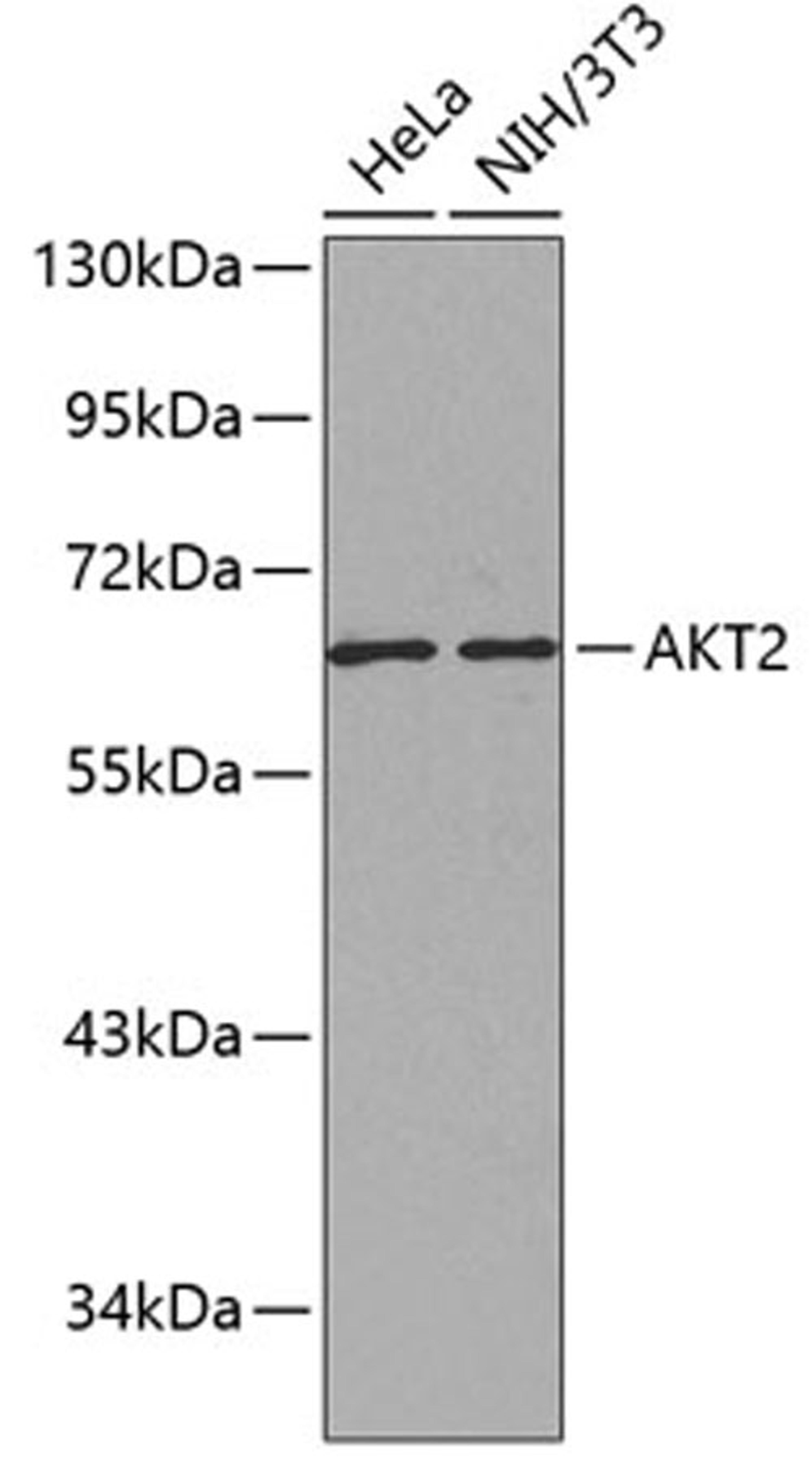 Western blot - AKT2 antibody (A0336)