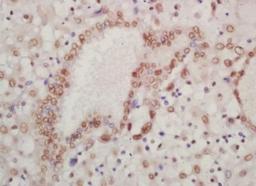 Immunohistochemical analysis of formalin-fixed paraffin embedded human placenta tissue using HOXA13 antibody (dilution at 1:200)