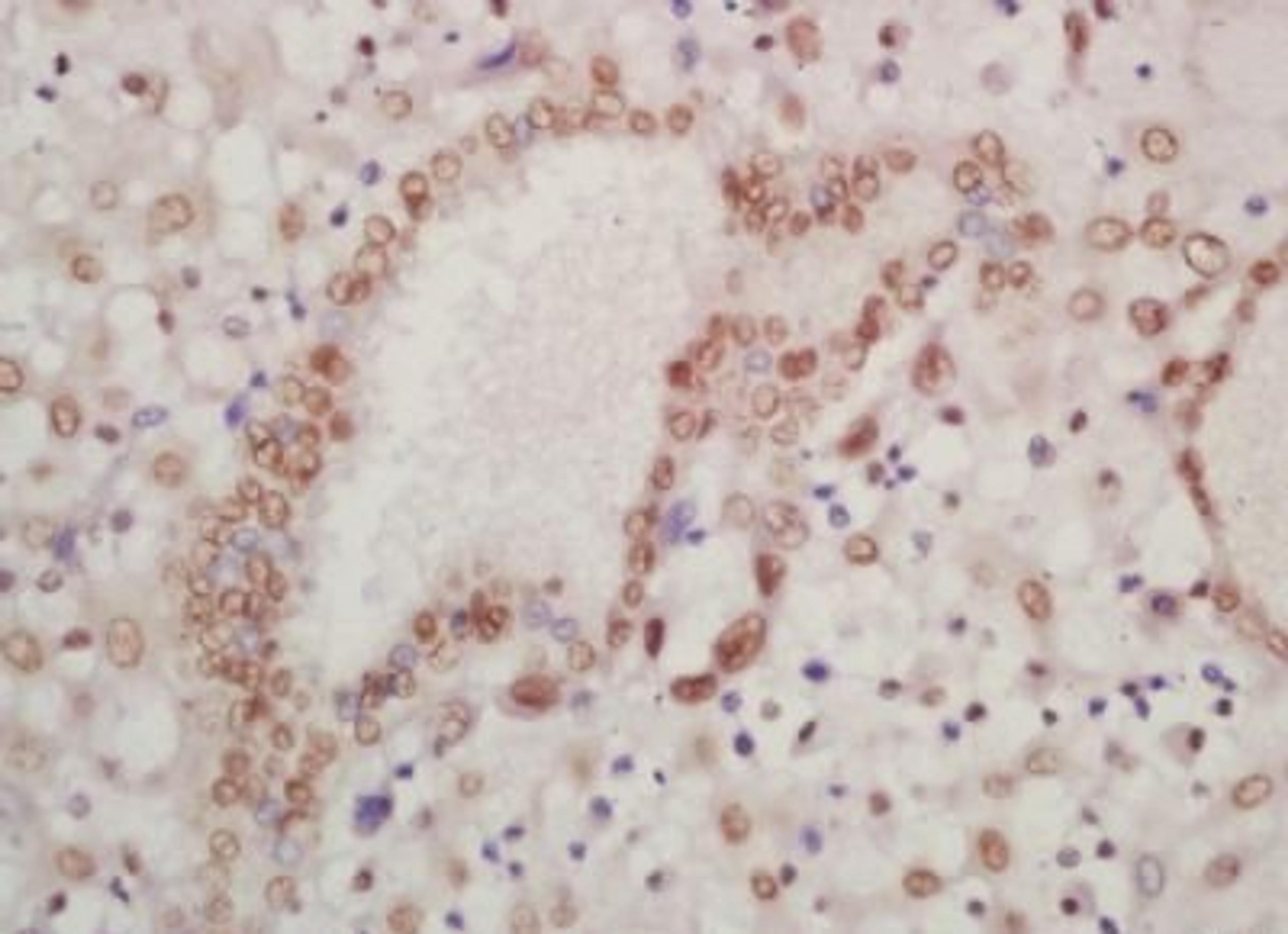 Immunohistochemical analysis of formalin-fixed paraffin embedded human placenta tissue using HOXA13 antibody (dilution at 1:200)