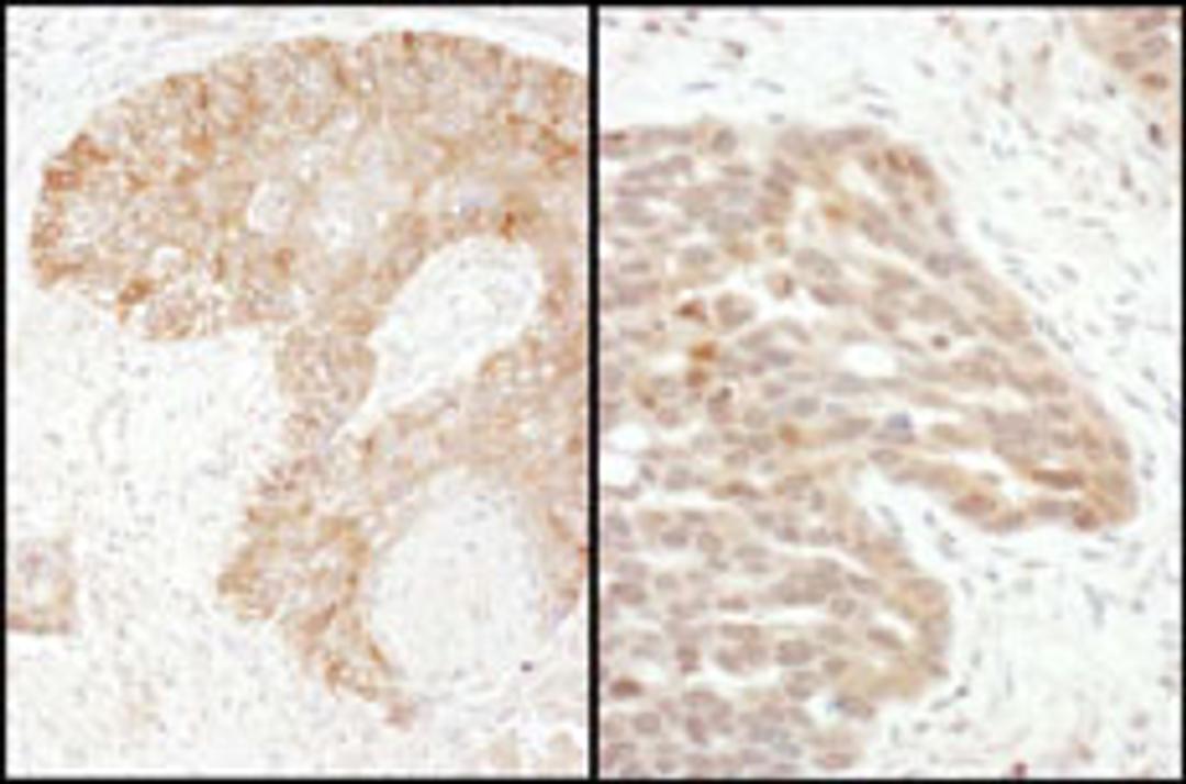 Detection of human TS by immunohistochemistry.